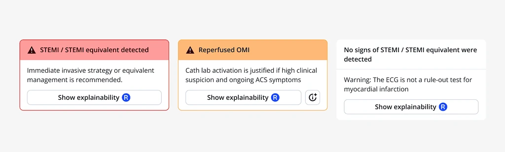 PMcardio ACS module three output states STEMI equivalent, Reperfused OMI, and no signs detected