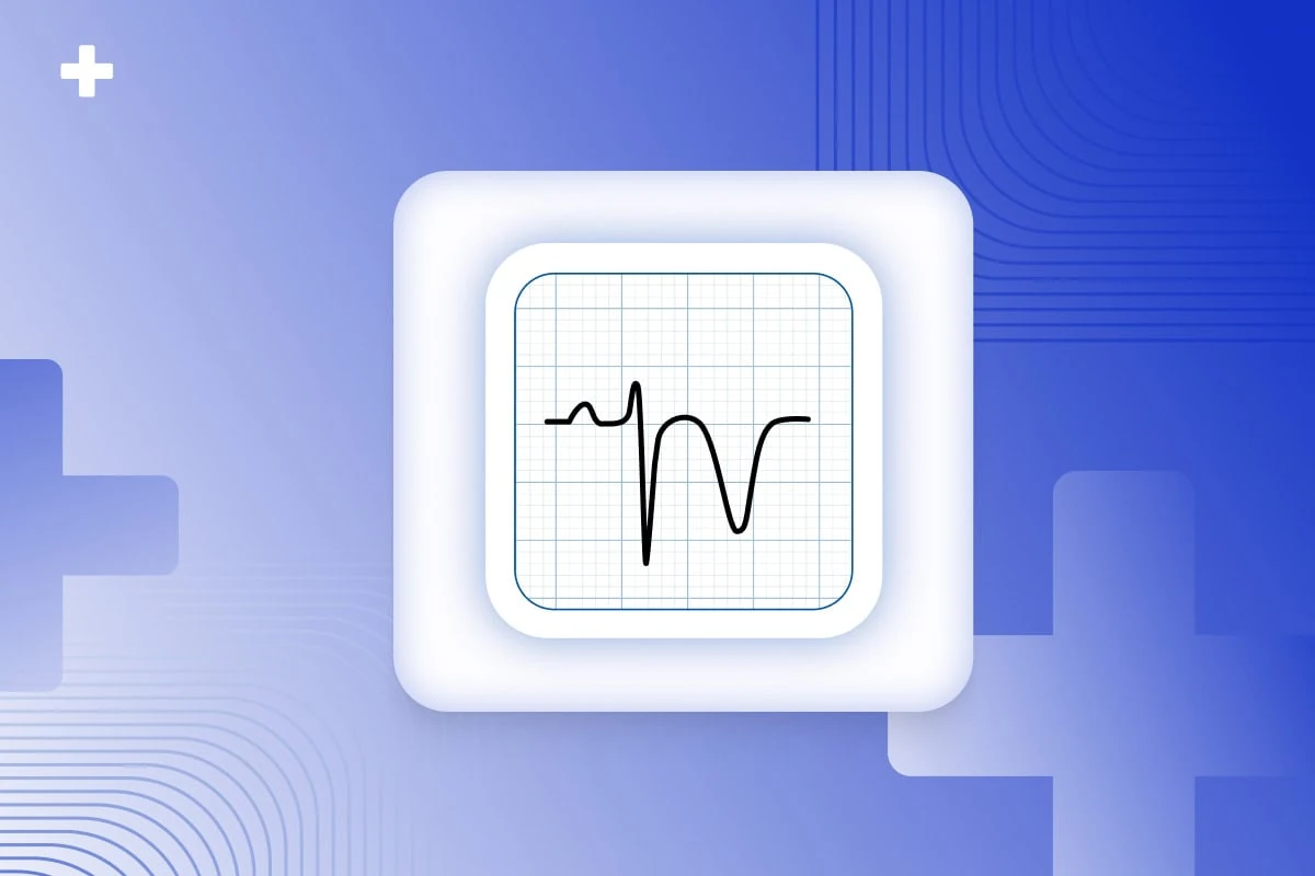 Stylized ECG waveform on grid paper over a blue medical blog cover for AI in cardiology