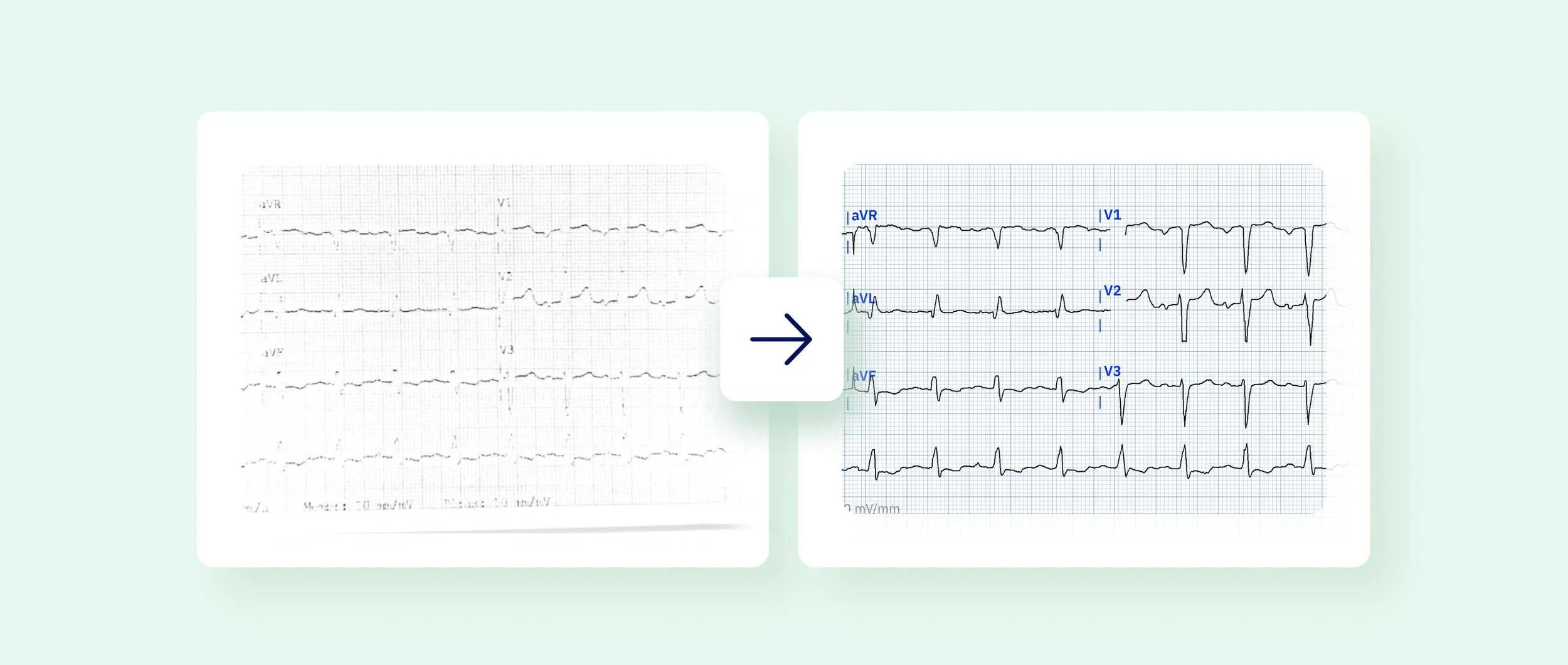 PMcardio ECG digitisation turning a noisy paper 12-lead ECG into a clean tracing