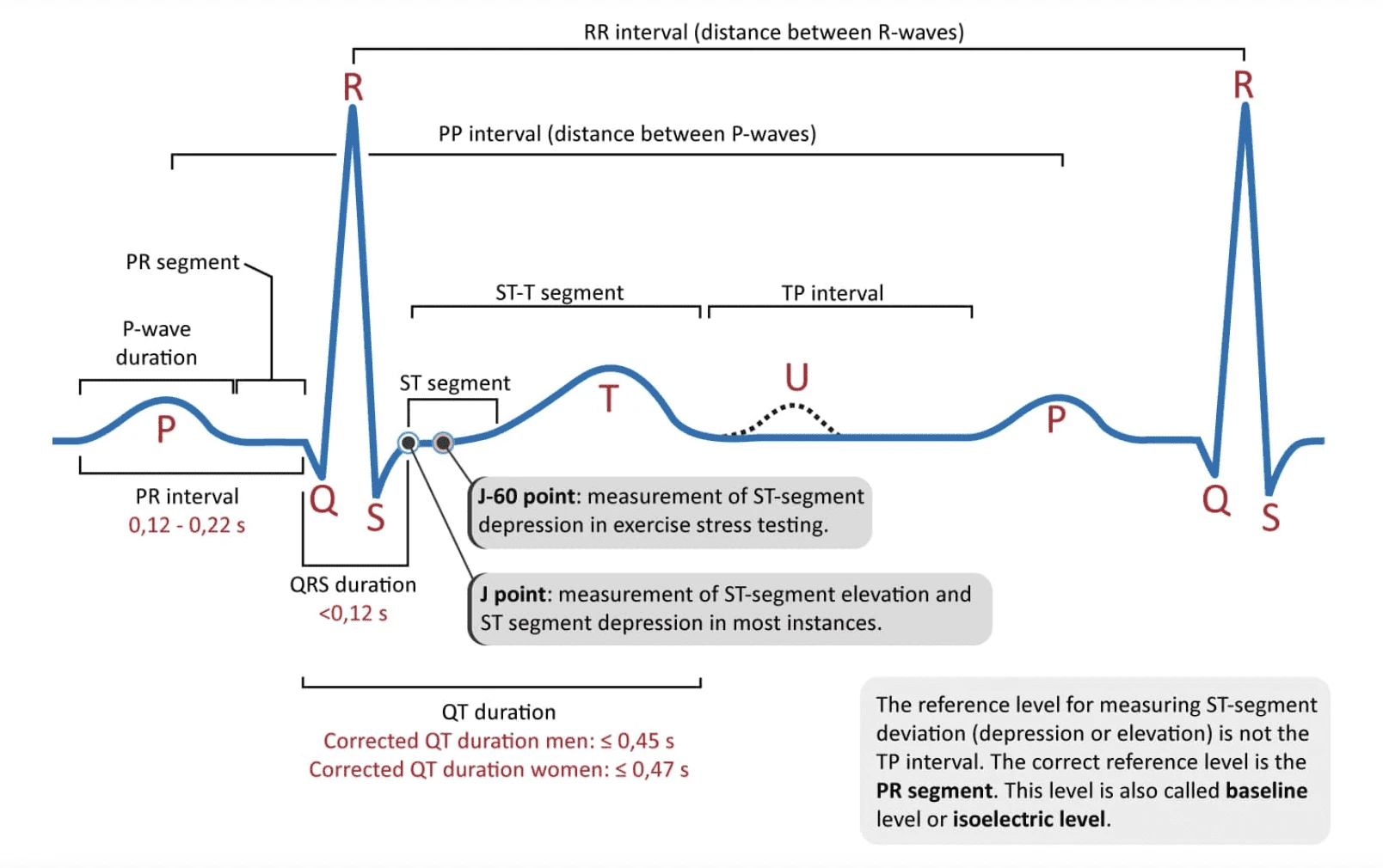 Fiducial points in an ECG signal.