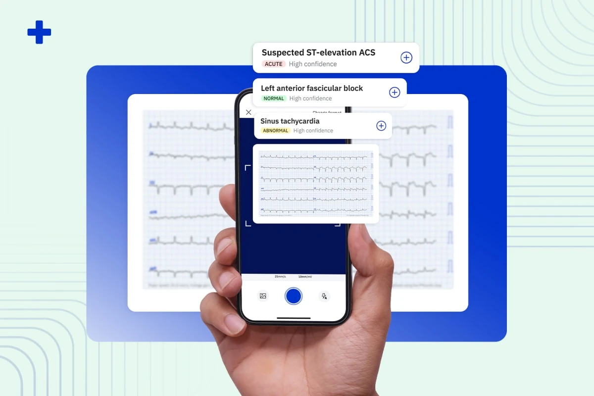 PMcardio app scanning a 12-lead ECG on a phone, flagging suspected ST-elevation ACS and other diagnoses