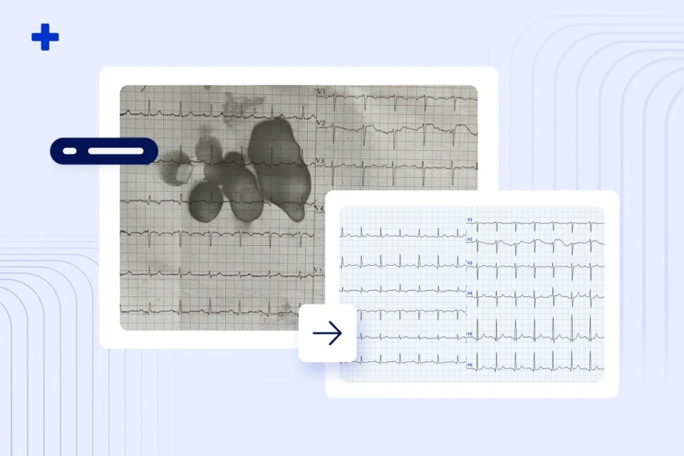 Stained paper ECG digitized by PMcardio into a clean 12-lead tracing