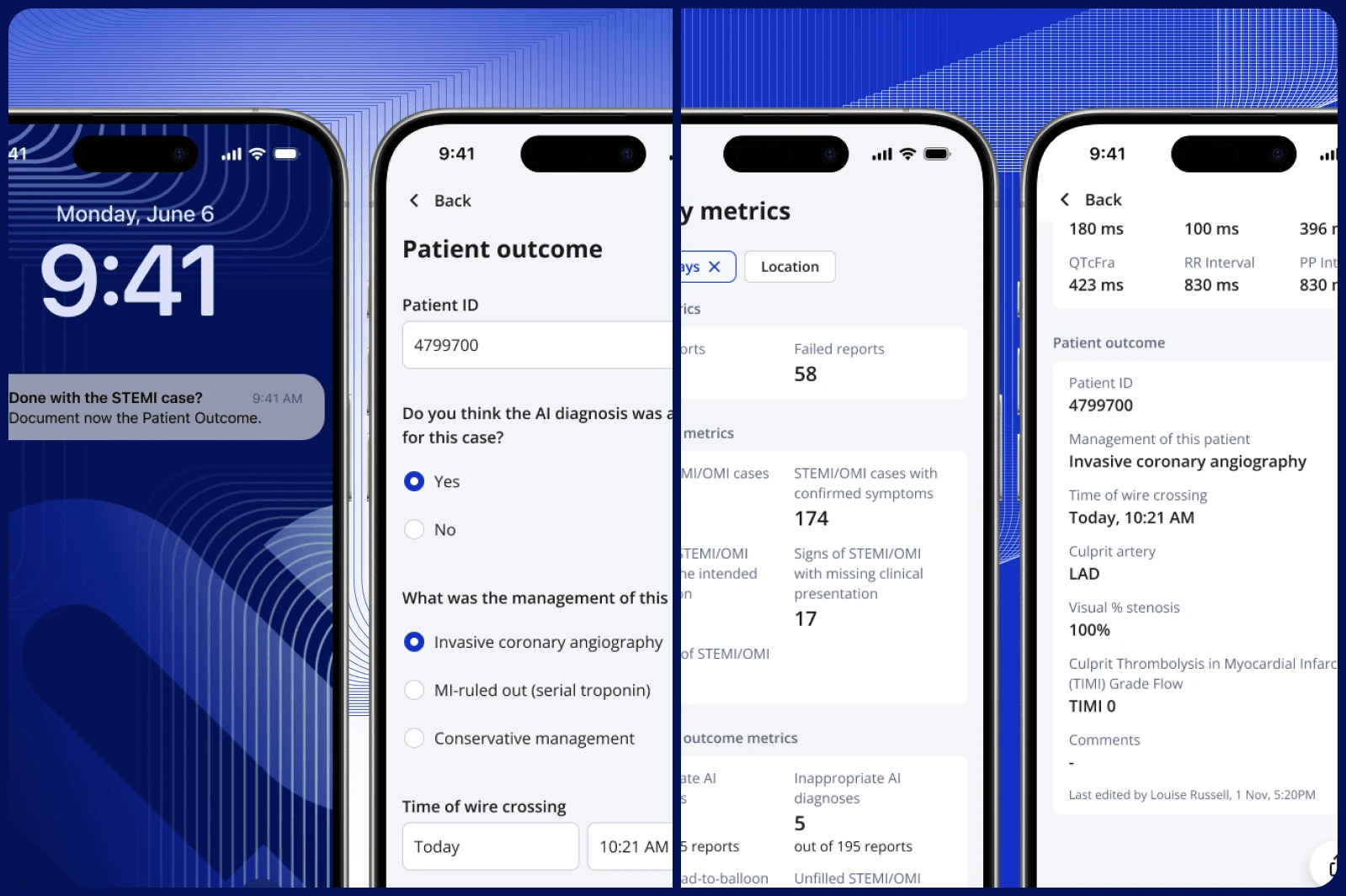 PMcardio app screens showing STEMI case alert, patient outcome feedback form, and ACS quality-metrics dashboard