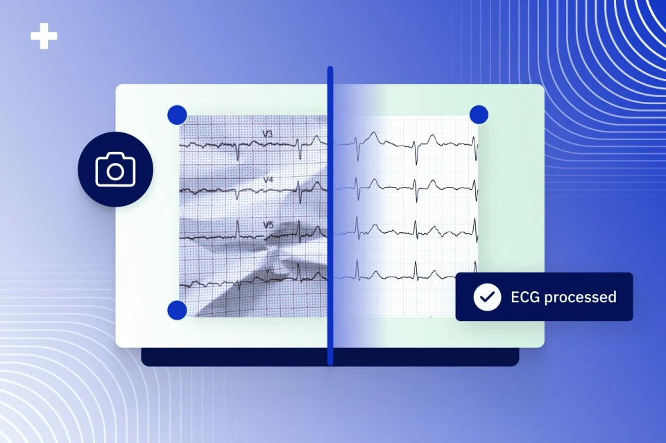 PMcardio Digitize converting a shadowed photographed 12-lead ECG into a clean digitized waveform