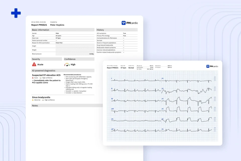 PMcardio ECG diagnostic report and digitized 12-lead ECG showing suspected ST-elevation ACS at acute severity