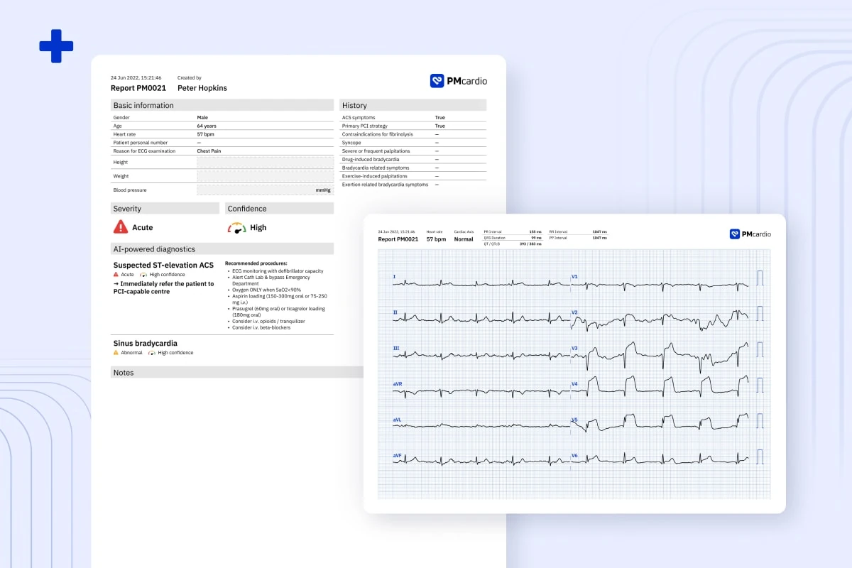 PMcardio ECG diagnostic report and digitized 12-lead ECG showing suspected ST-elevation ACS at acute severity