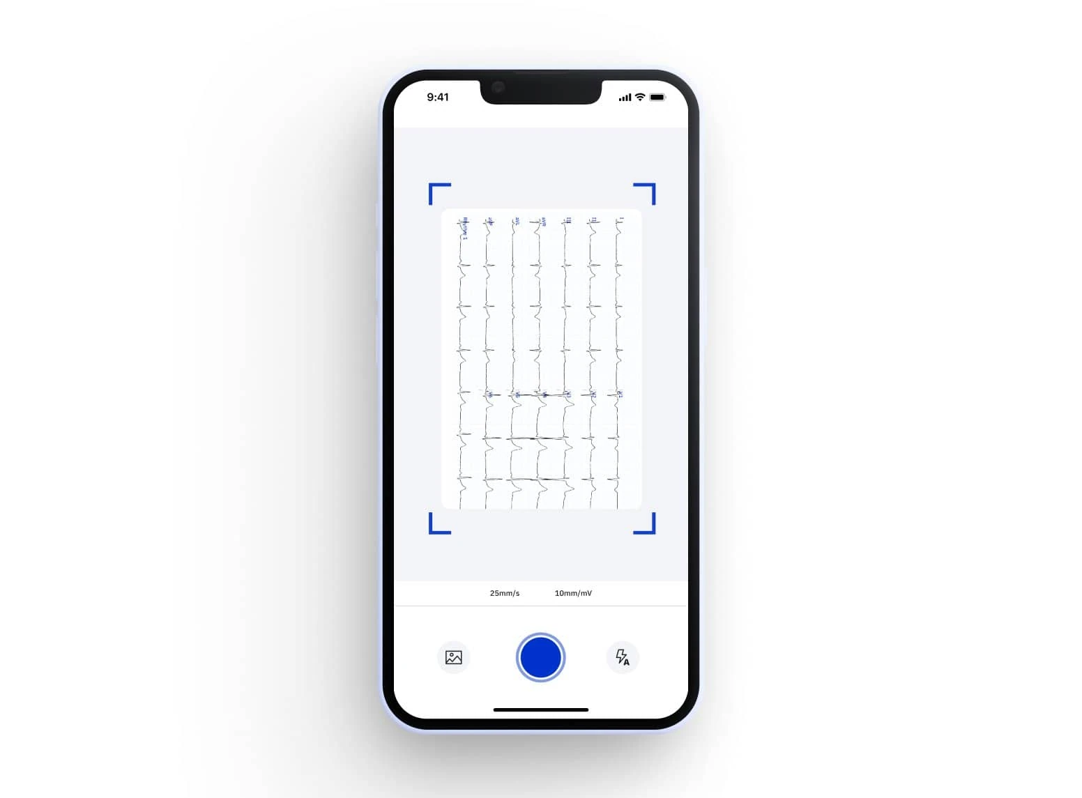 An image of PMcardio app showing the screen during digitizing an ECG