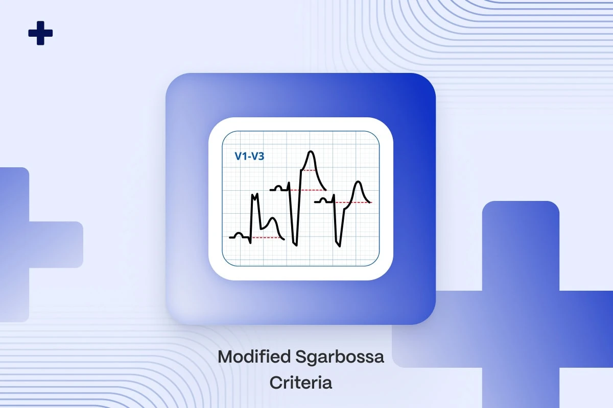 Modified Sgarbossa criteria cover graphic with a stylized ECG waveform in leads V1-V3