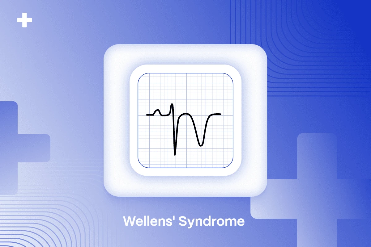 Wellens' Syndrome blog cover with a stylized ECG tracing on a blue background