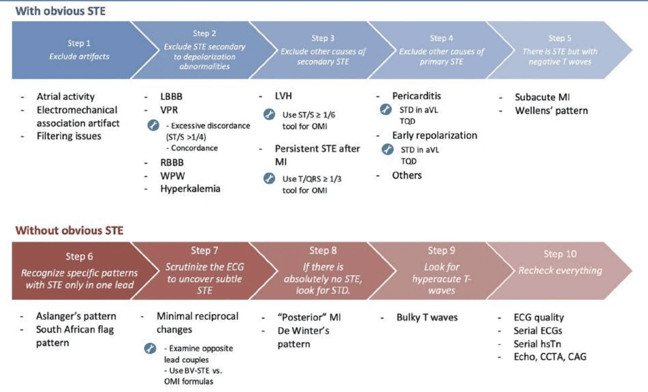 Aslanger ten-step flowchart for identifying OMI on 12-lead ECG with and without obvious ST elevation