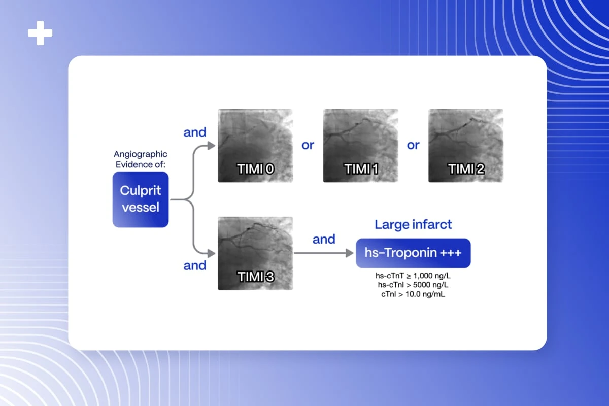 Angiographic OMI definition showing culprit vessel with TIMI 0-2 flow or TIMI 3 flow plus high troponin