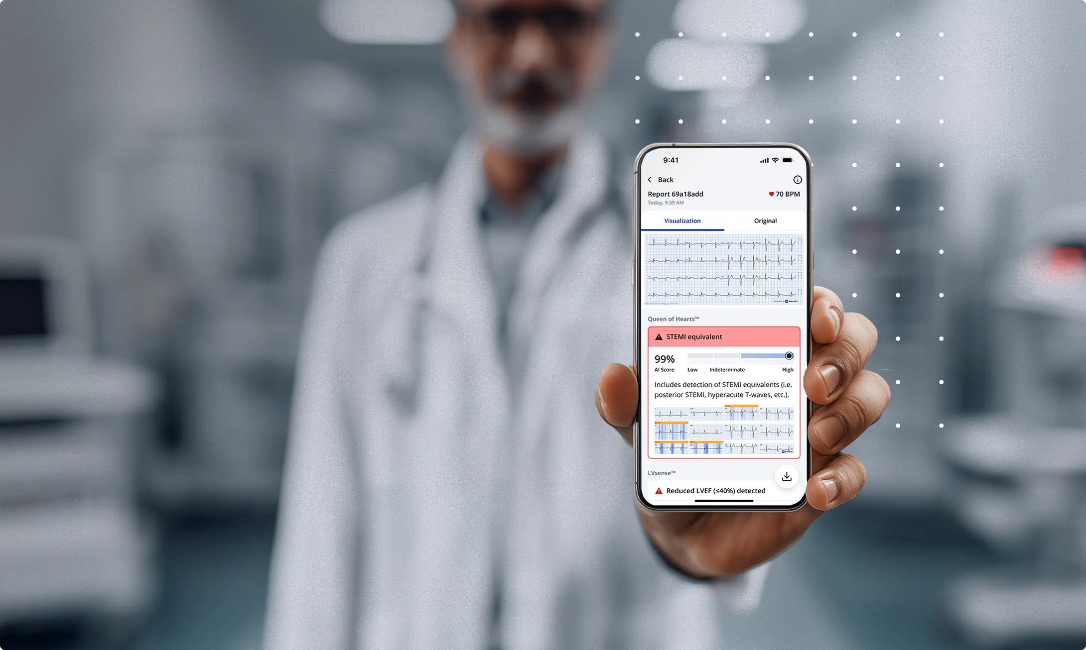Clinician holding a smartphone showing the PMcardio app with a Queen of Hearts STEMI equivalent ECG report