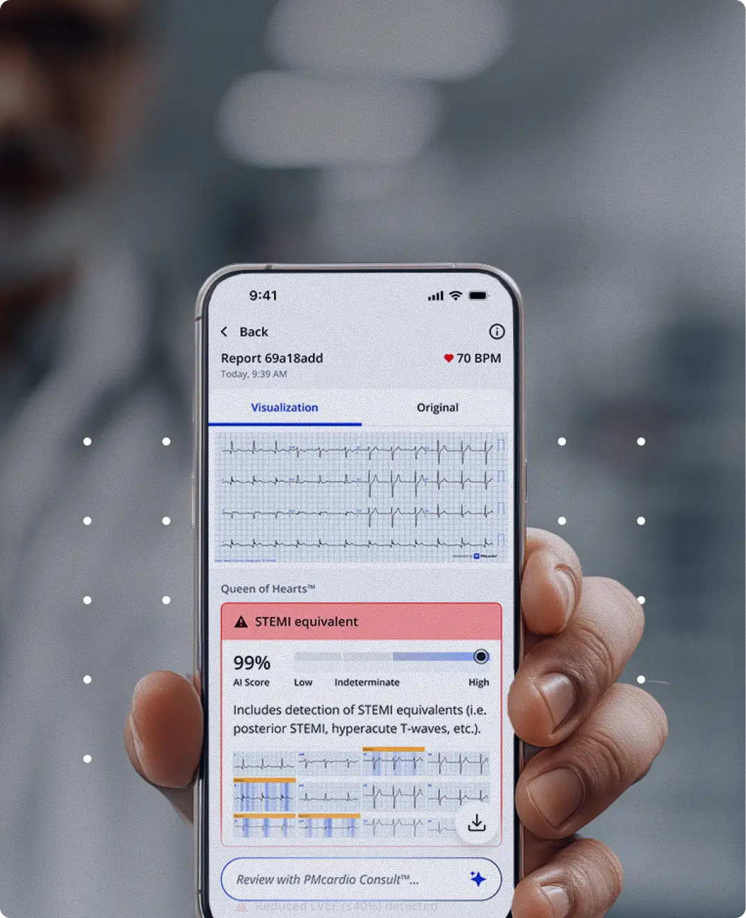 Clinician holding a phone showing the PMcardio app with a Queen of Hearts STEMI equivalent ECG alert