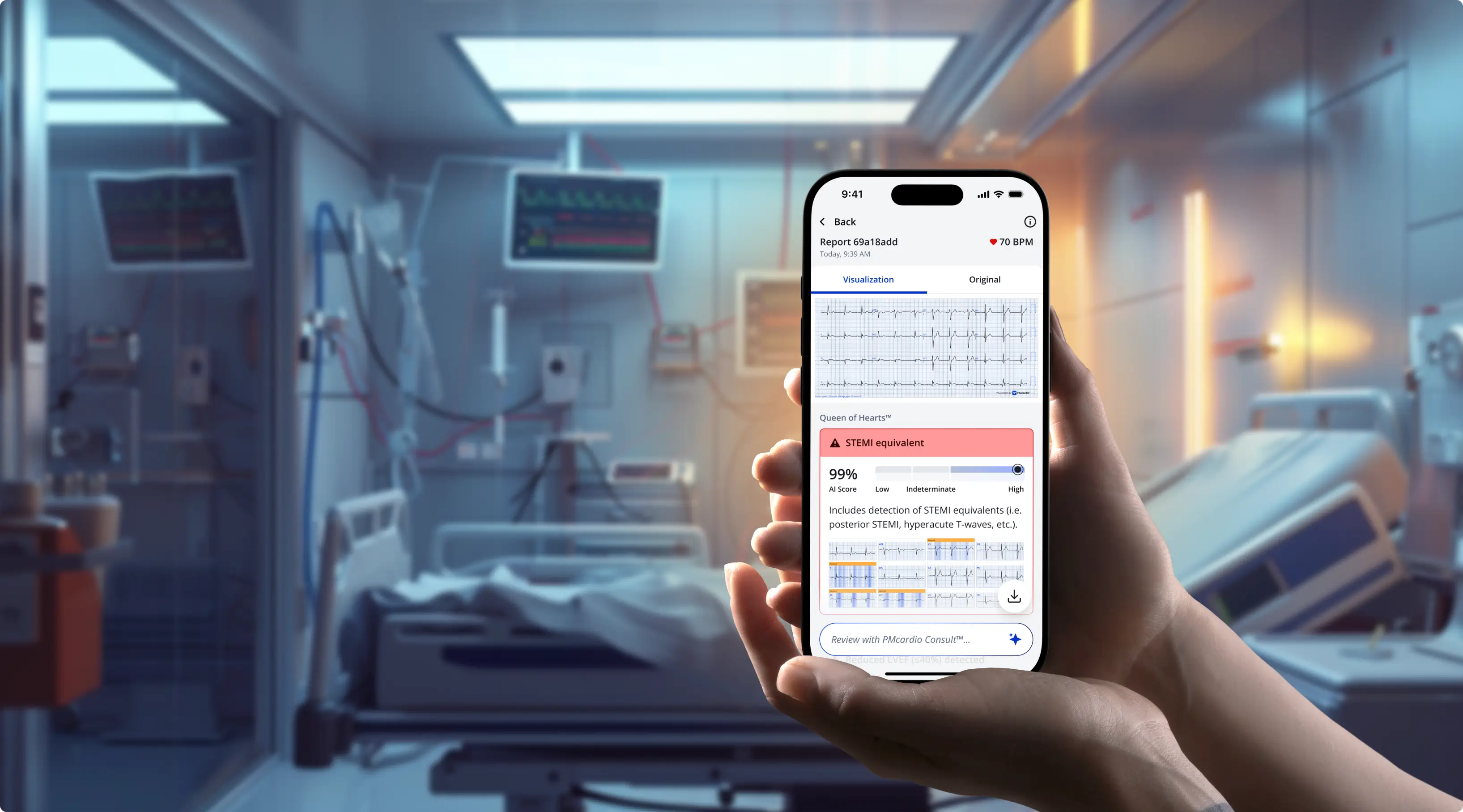 Clinician holding a phone showing the PMcardio app with an OMI/STEMI equivalent alert in an emergency room