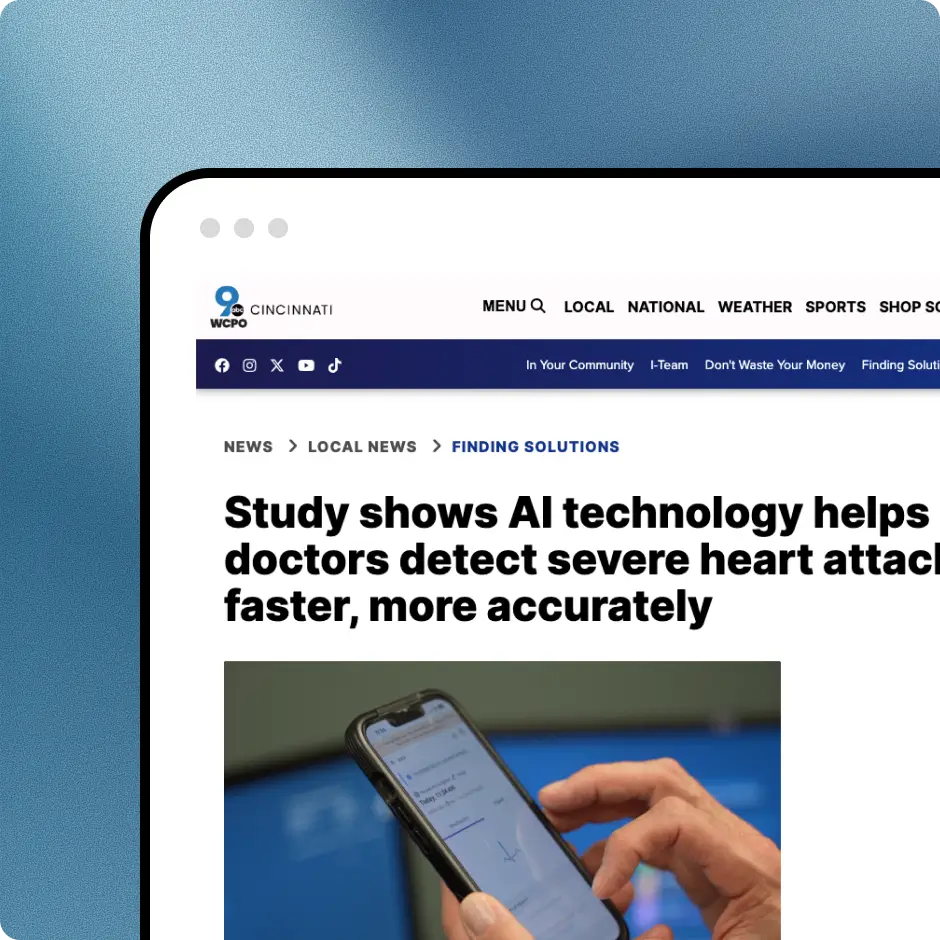 WCPO 9 Cincinnati article headline on a study showing AI helps doctors detect severe heart attacks faster