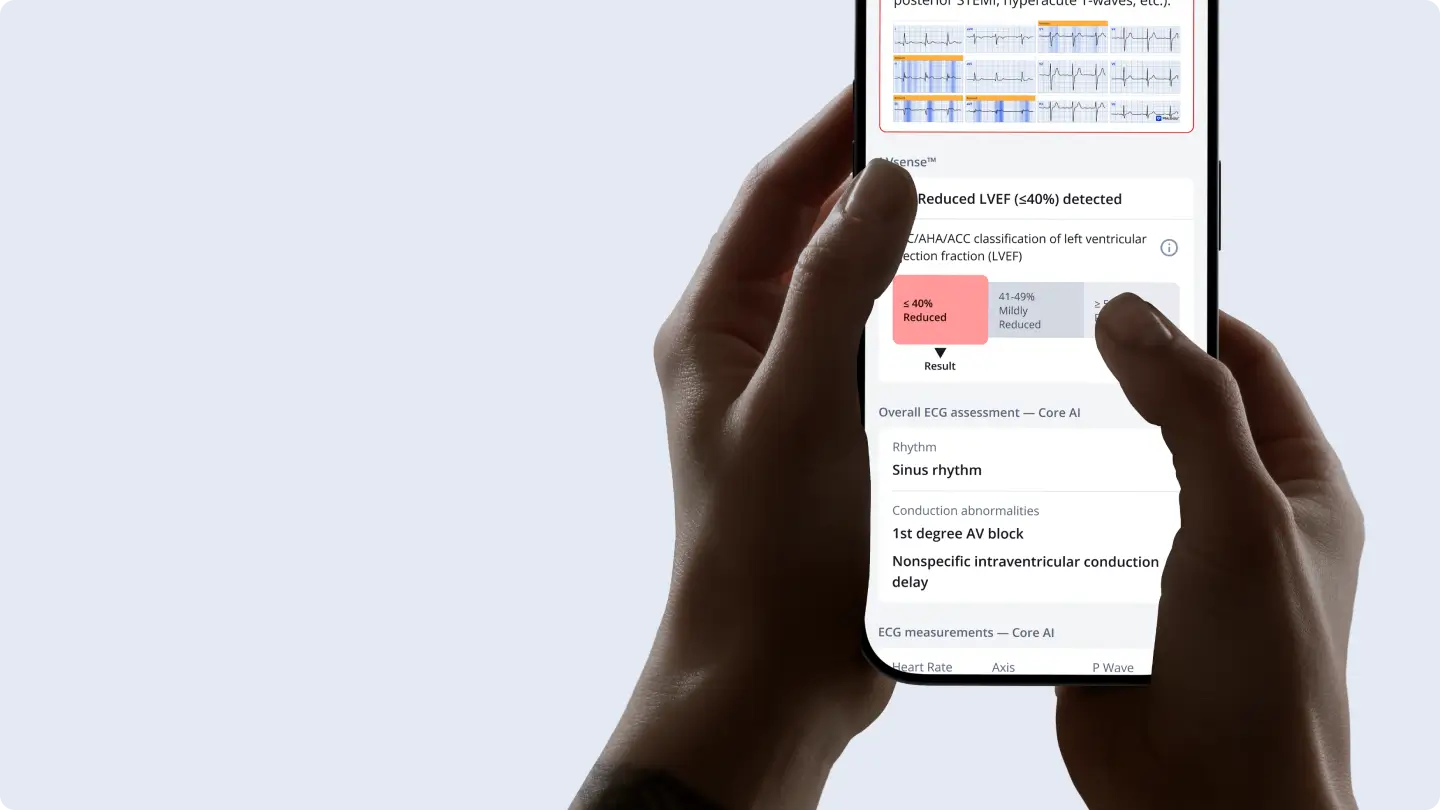 Phone showing PMcardio LVsense reduced LVEF result and Core AI ECG assessment
