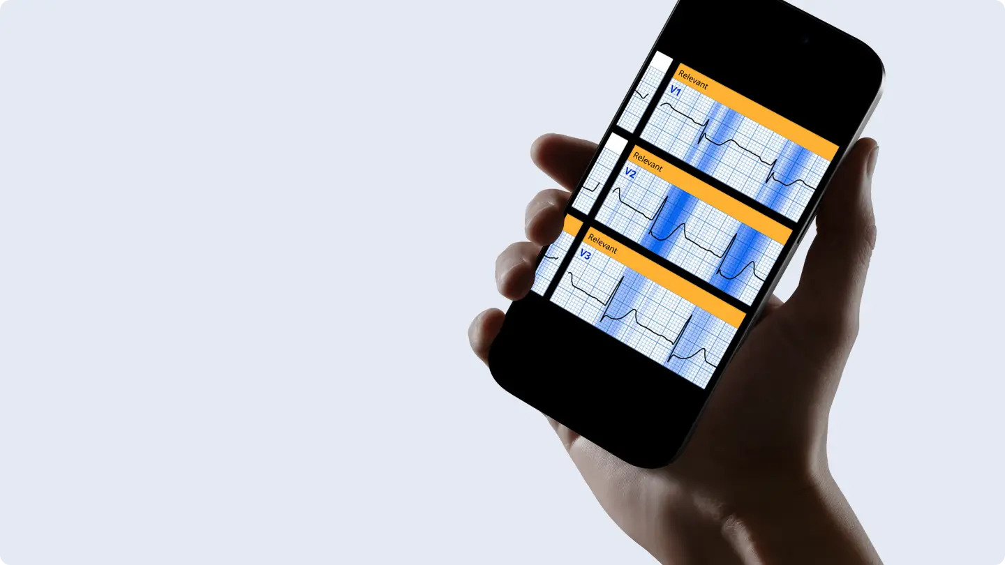 Phone showing PMcardio ECGxplain heatmaps highlighting relevant leads V1 to V3