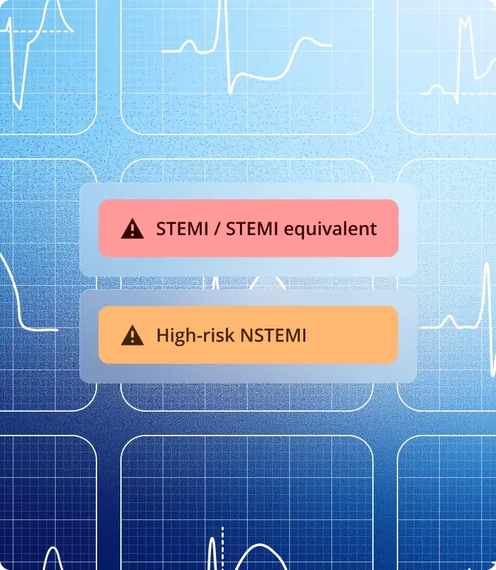 PMcardio Queen of Hearts flagging STEMI, STEMI equivalent and high-risk NSTEMI on a 12-lead ECG