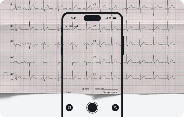 Smartphone digitizing a printed 12-lead ECG, working from any ECG image