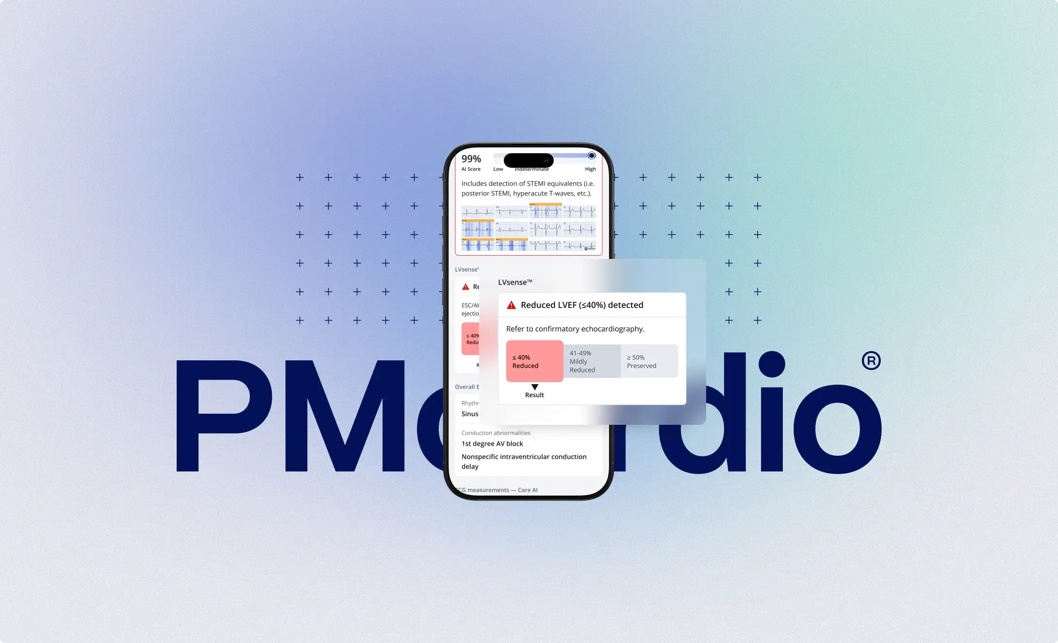 PMcardio LVsense screen with 99% AI score and reduced LVEF under 40% detection alert