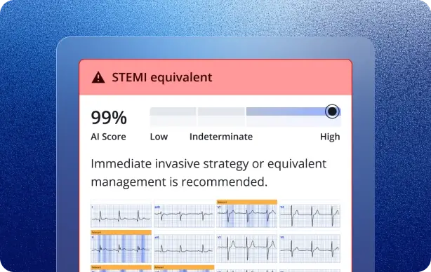 PMcardio flagging a STEMI equivalent at 99 percent AI score recommending immediate invasive strategy