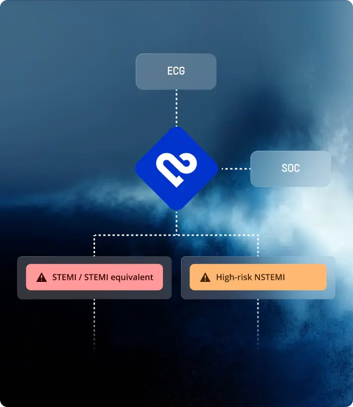 Decision tree classifying an ECG as STEMI equivalent or high-risk NSTEMI beyond standard criteria