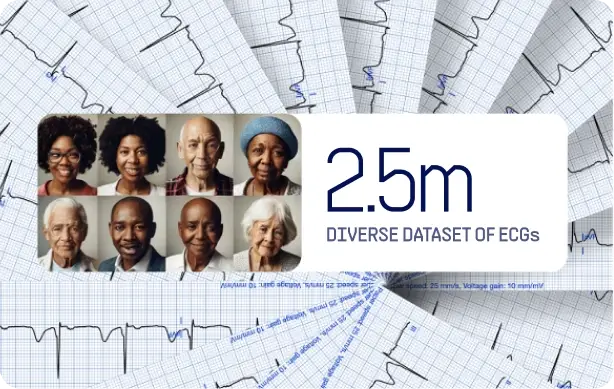 Ethnically diverse patient faces over ECG strips labeled 2.5m diverse dataset of ECGs