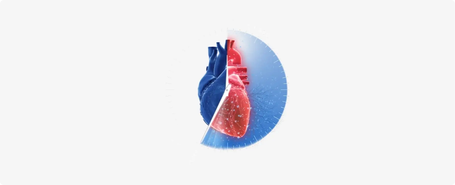 Anatomical heart with radial timer illustrating time-dependent myocardial salvage lost during reperfusion delay
