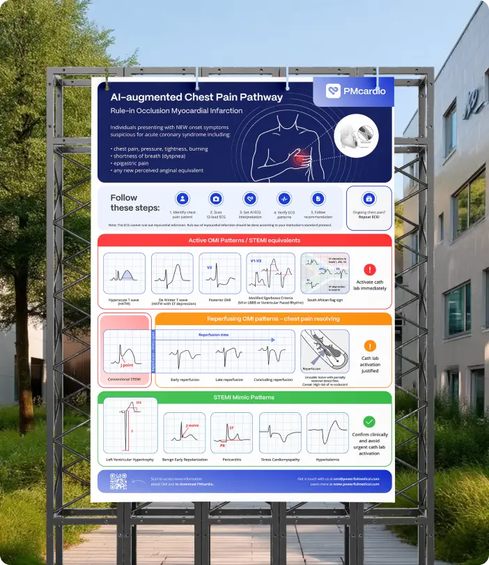 PMcardio AI-augmented Chest Pain Pathway poster displayed on an outdoor billboard