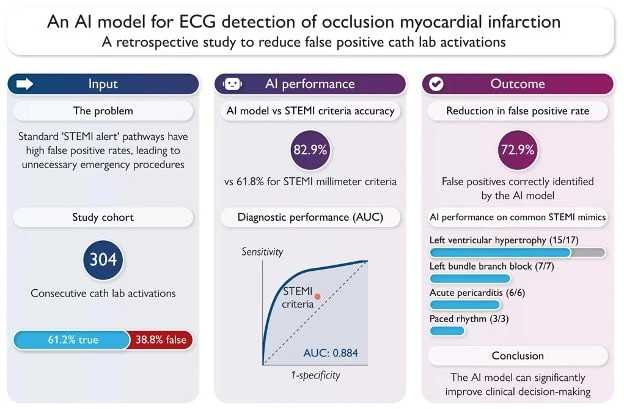 Visual abstract comparing PMcardio AI OMI model to STEMI criteria across 304 cath lab activations, 82.9% accuracy, AUC 0.884