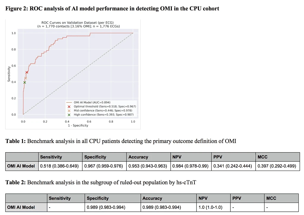ROC curve showing PMcardio OMI AI ECG model reaching AUC 0.894 with 96.7 percent specificity in the German CPU cohort