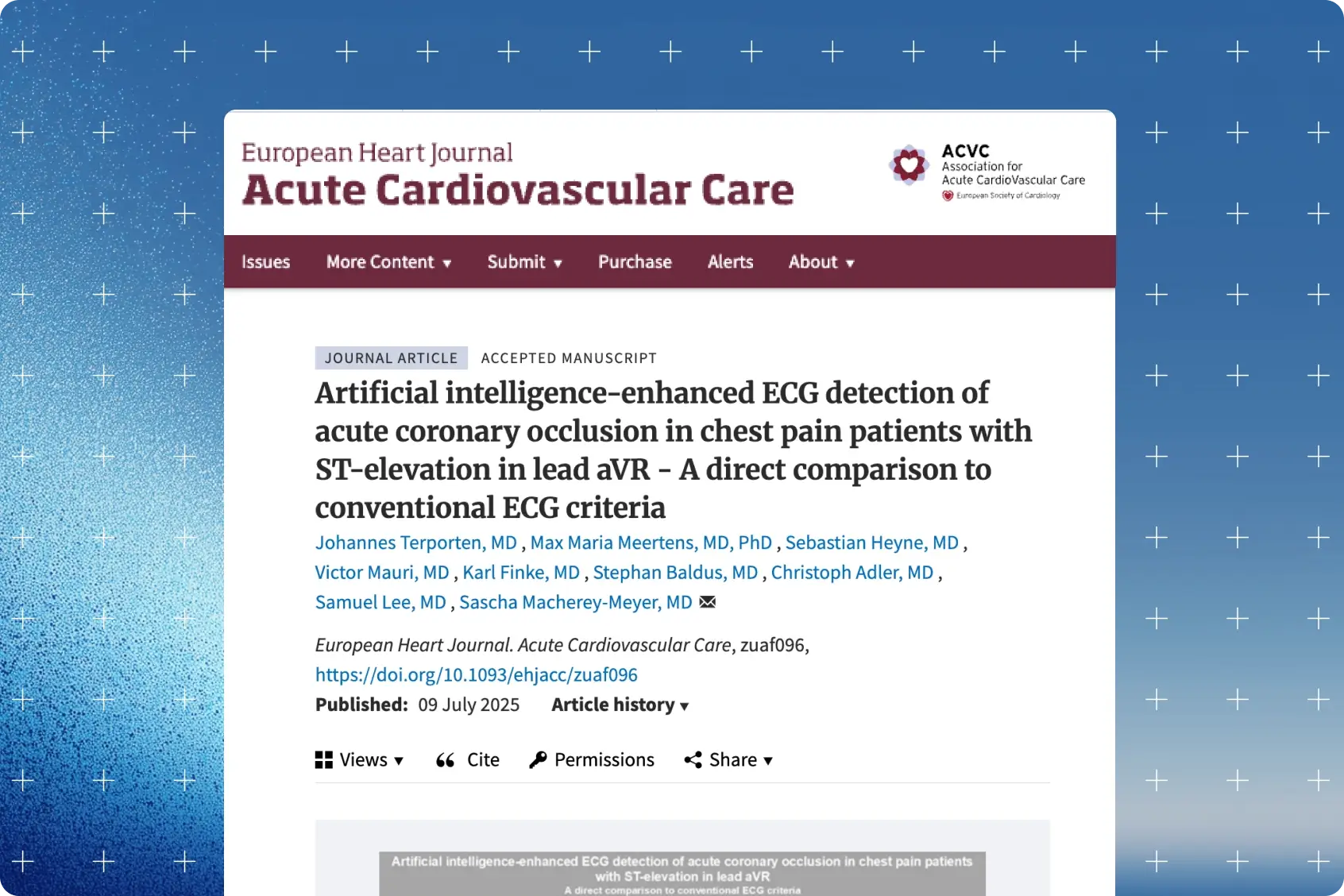 European Heart Journal Acute Cardiovascular Care article page for the aVR ST-elevation AI ECG study