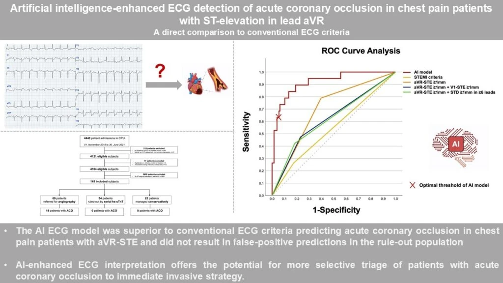 ROC curve analysis showing PMcardio AI outperforming STEMI criteria for acute coronary occlusion in aVR ST-elevation ECGs
