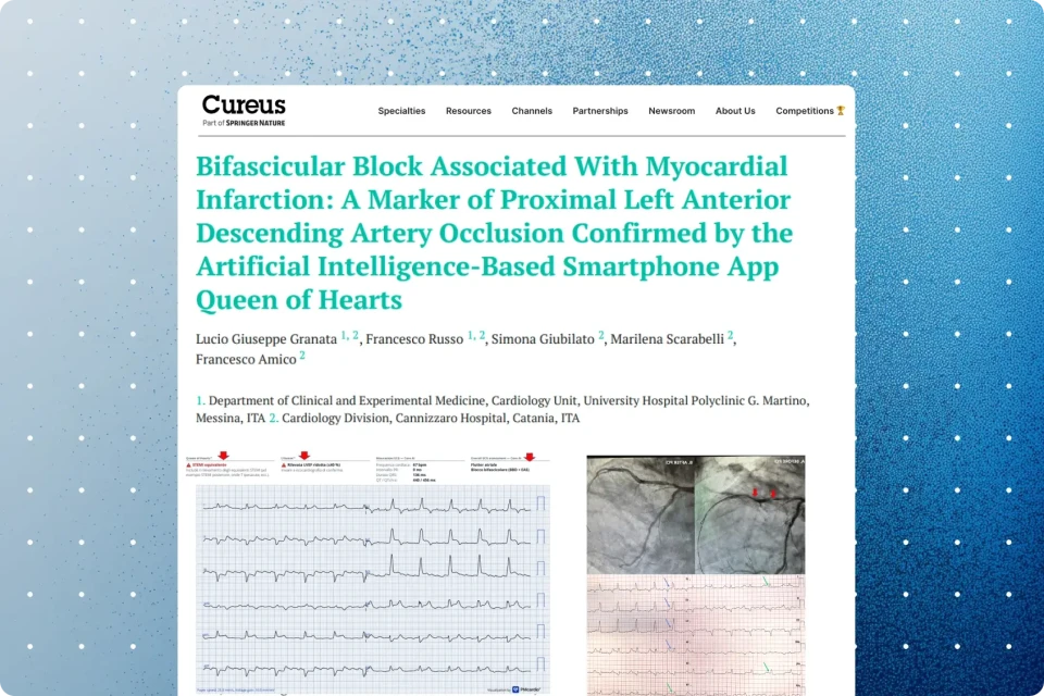 Bifascicular Block Associated With Myocardial Infarction: A Marker of Proximal Left Anterior Descending Artery Occlusion Confirmed by the Artificial Intelligence-Based Smartphone App Queen of Hearts