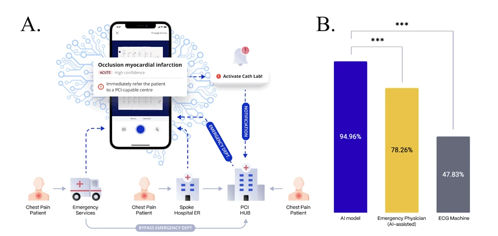 Deep-learning Assisted ECG-based Emergent Cathlab Activation
