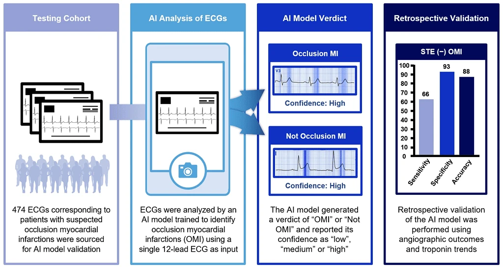 Study workflow: AI ECG model scores 474 suspected-OMI cases, reaching 93% specificity and 88% accuracy on STE-negative OMI