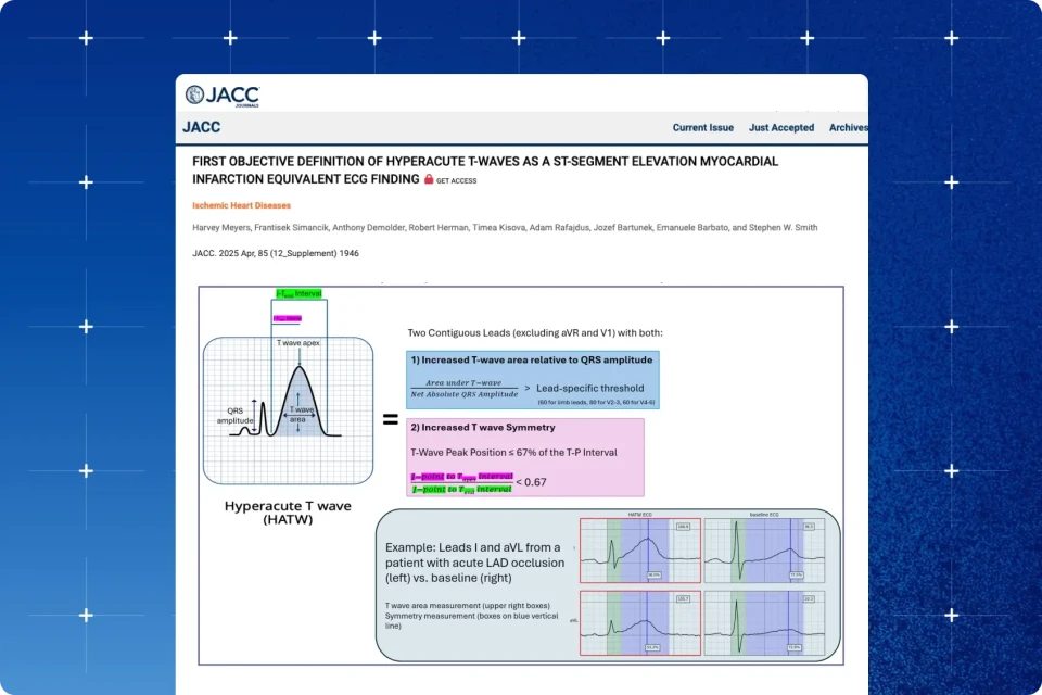 First Objective Definition of Hyperacute T-waves as a ST-segment Elevation Myocardial Infarction Equivalent ECG Finding