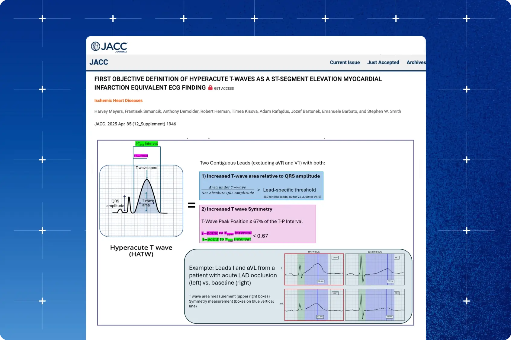 JACC article card for the hyperacute T-wave STEMI equivalent study showing the HATW objective definition figure