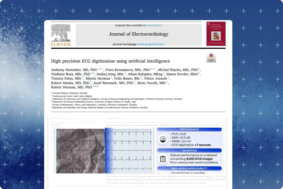 Journal of Electrocardiology article title page for the high-precision AI ECG digitization study on ScienceDirect