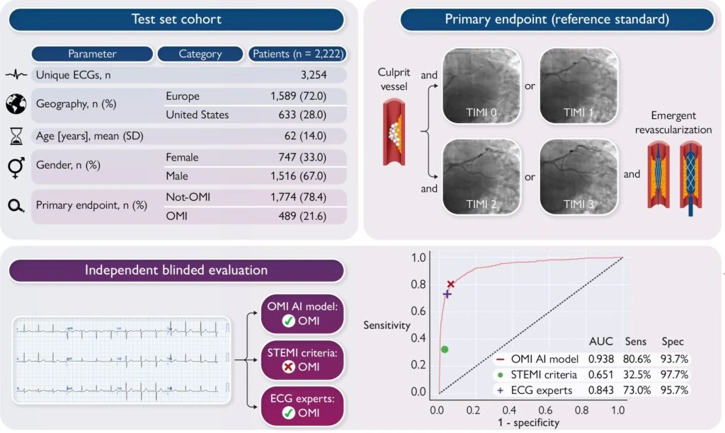 Graphical abstract showing PMcardio OMI AI model reaching AUC 0.938, outperforming STEMI criteria on the ROC curve