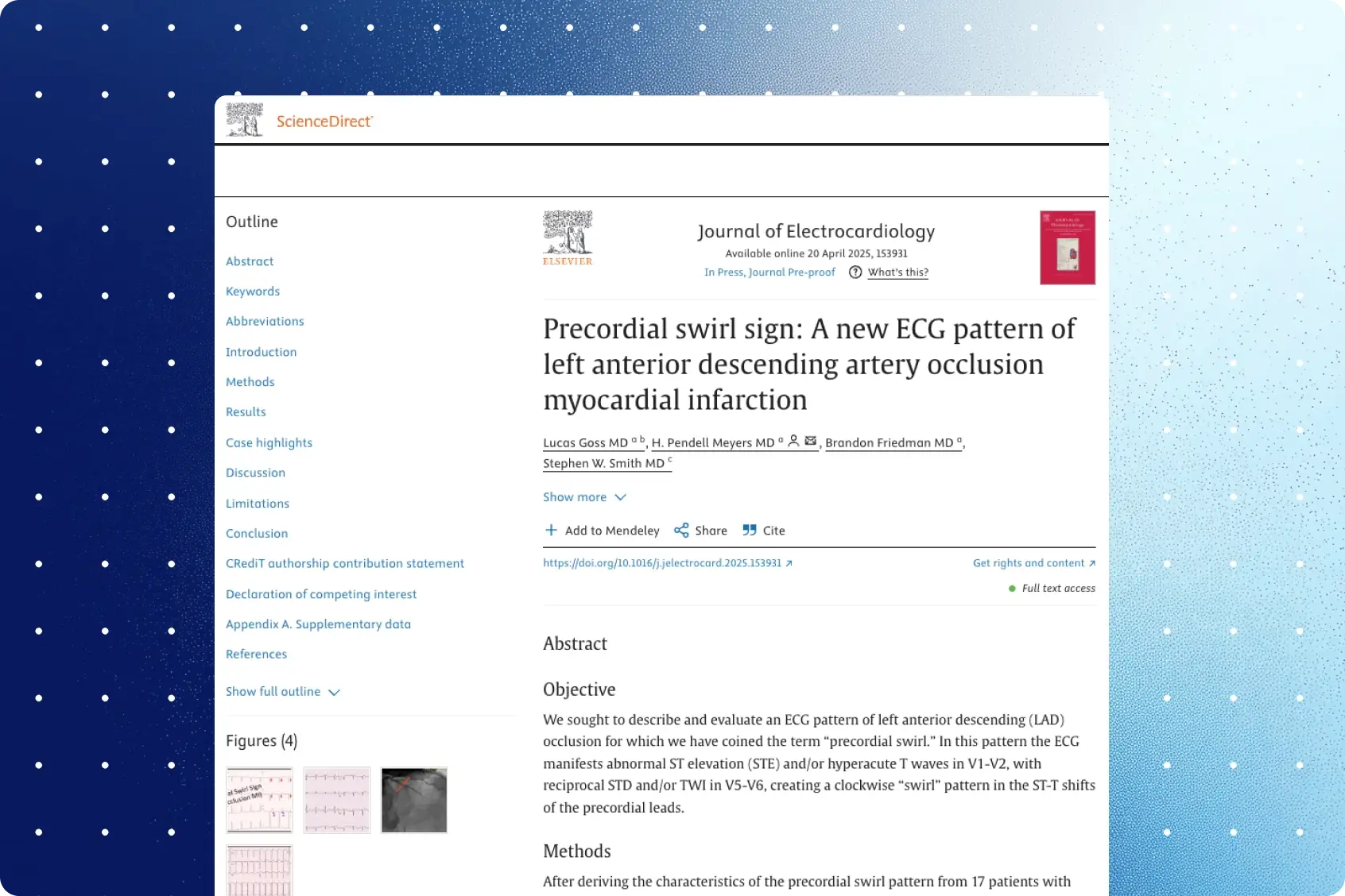 Journal of Electrocardiology article page on ScienceDirect for the precordial swirl sign LAD occlusion MI study