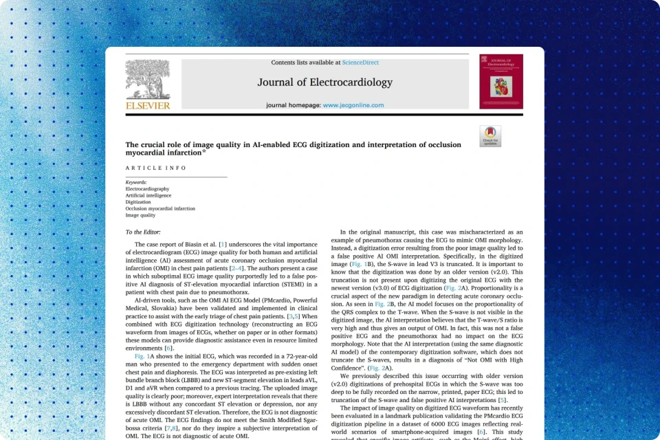 The Crucial Role of Image Quality in AI-enabled ECG Digitization and Interpretation of Occlusion Myocardial Infarction