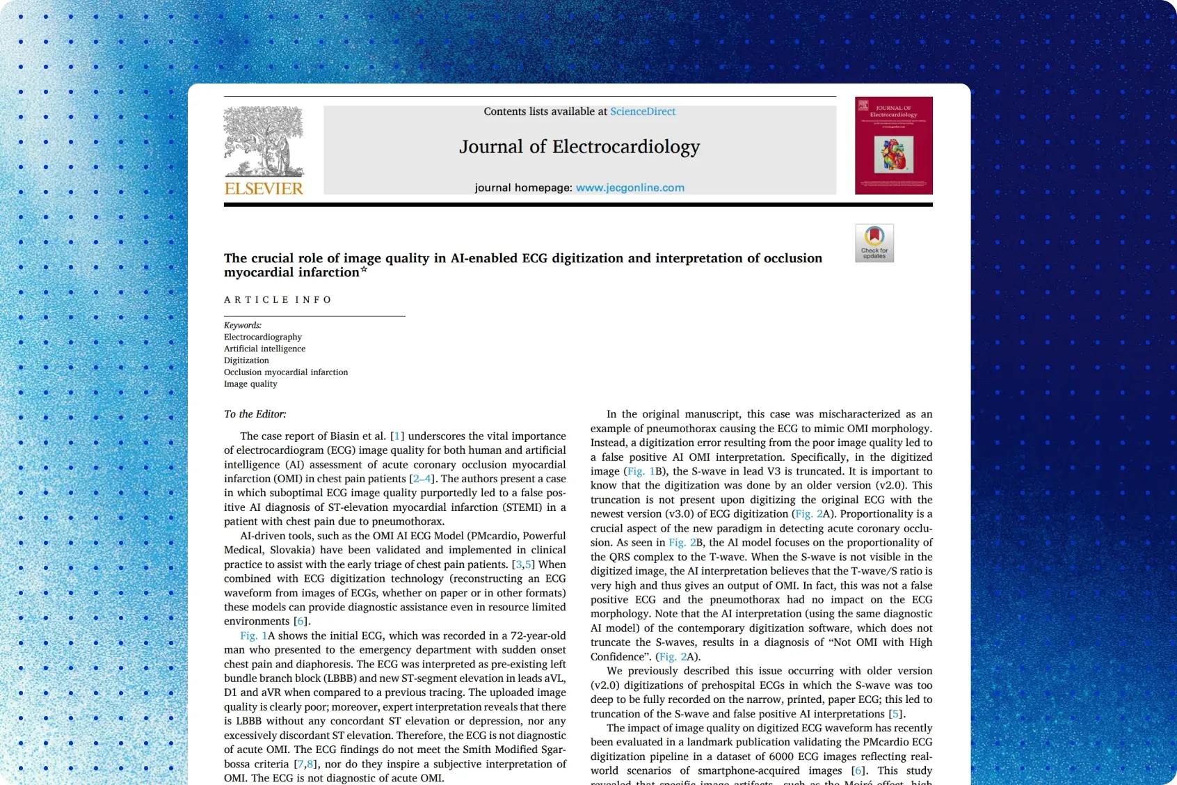 Journal of Electrocardiology paper on how ECG image quality affects AI-enabled digitization and OMI interpretation