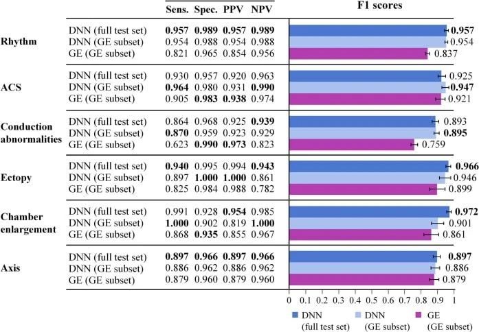 Chart comparing DNN and GE Marquette 12SL F1 scores across six ECG diagnostic categories, with DNN outperforming