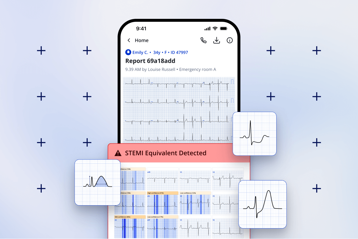 PMcardio mobile interface displaying STEMI equivalent detection alert with ECG waveform highlights.