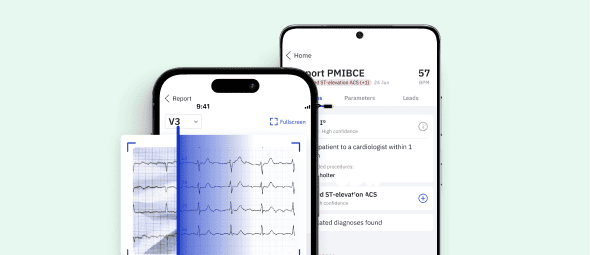 ECG Reader: AI-powered Expert Interpretation App