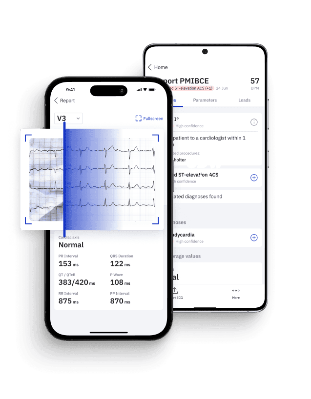 ECG Reader: AI-powered Expert Interpretation App