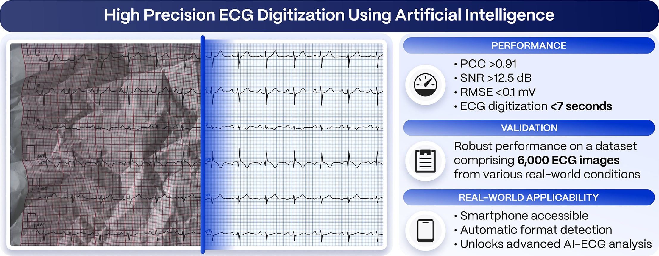 High Precision ECG Digitization Using Artificial Intelligence