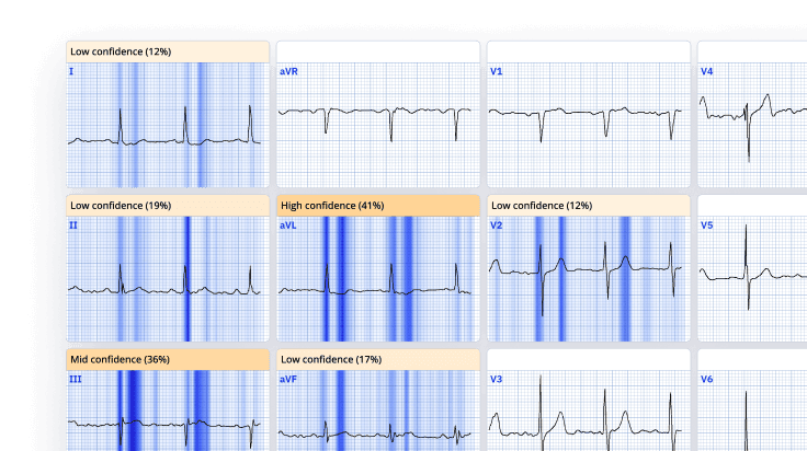 PMcardio App PMcardio App