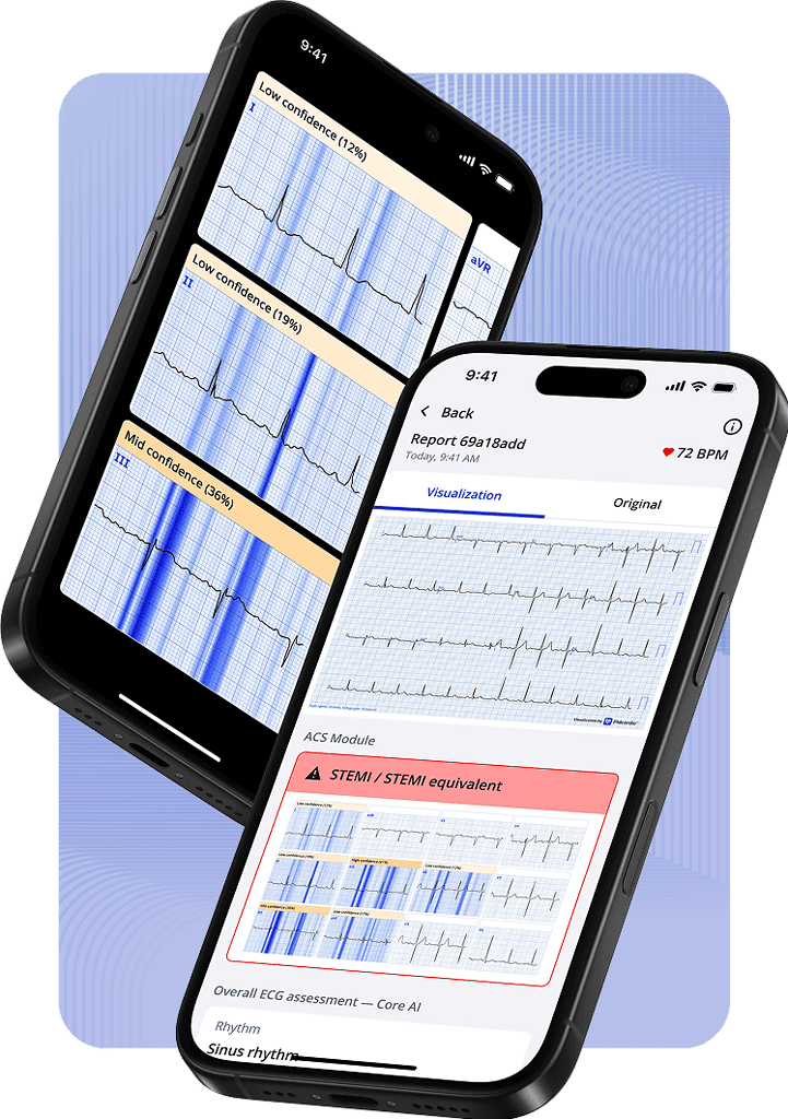 PMcardio App